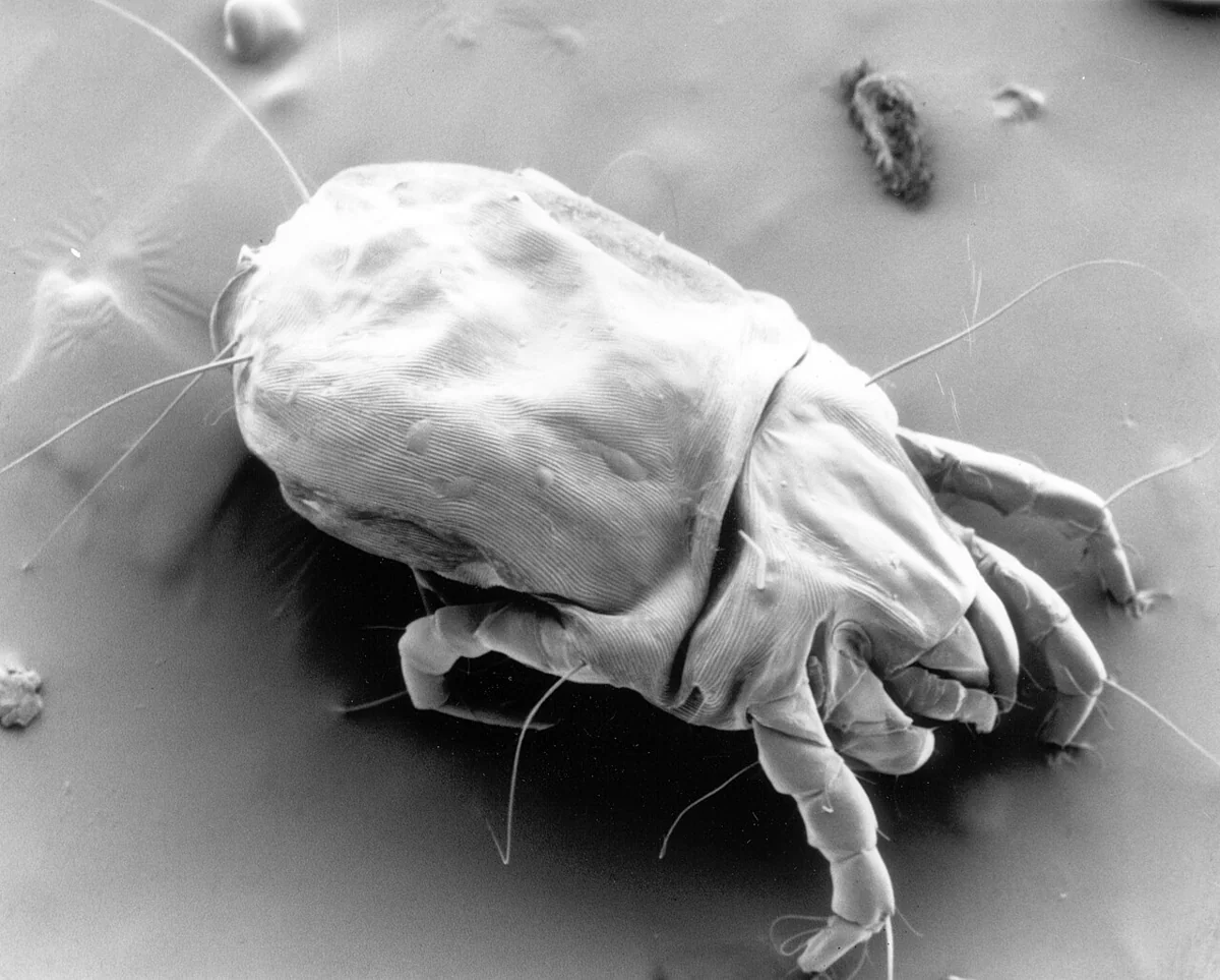 Scanning electron micrograph of a female house dust mite: a rounded, wrinkled, pale body with eight jointed legs and long fine hairs